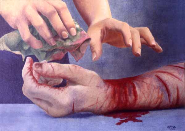 Preparing the body of Christ--the Great Physician--for burial